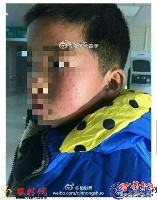\